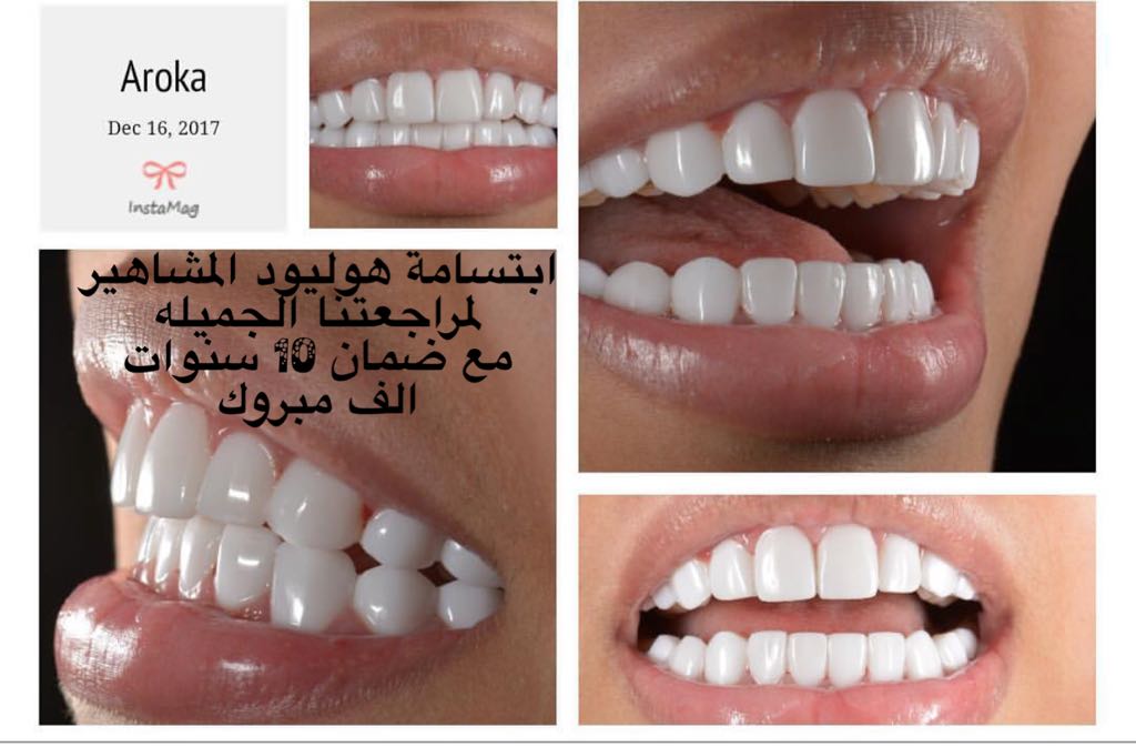 عيادة أسنان بالرياض 0545359682 عيادة جلديه بالرياض 