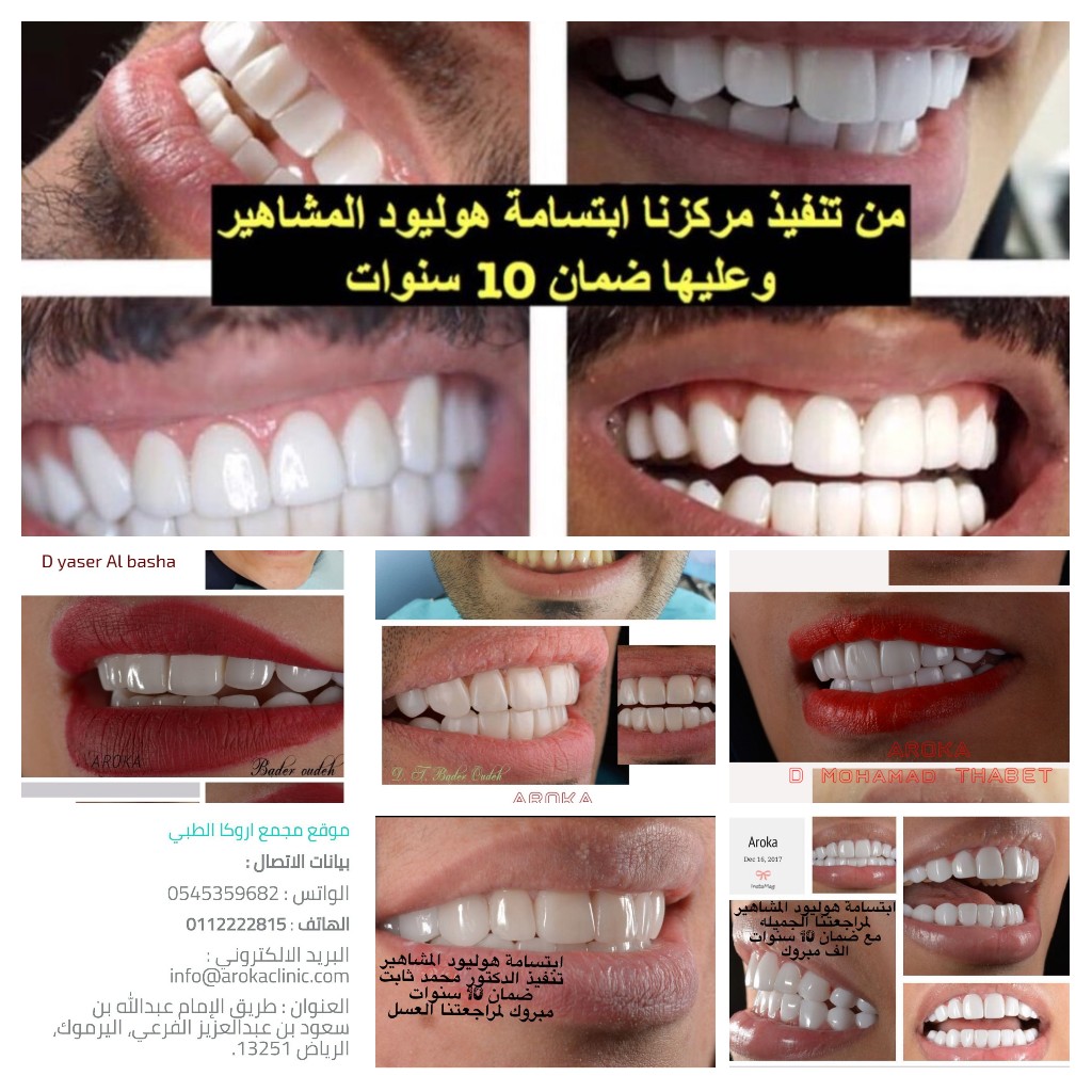 عيادة اروكا لطب الاسنان والجلدية شمال الرياض 0545359682 