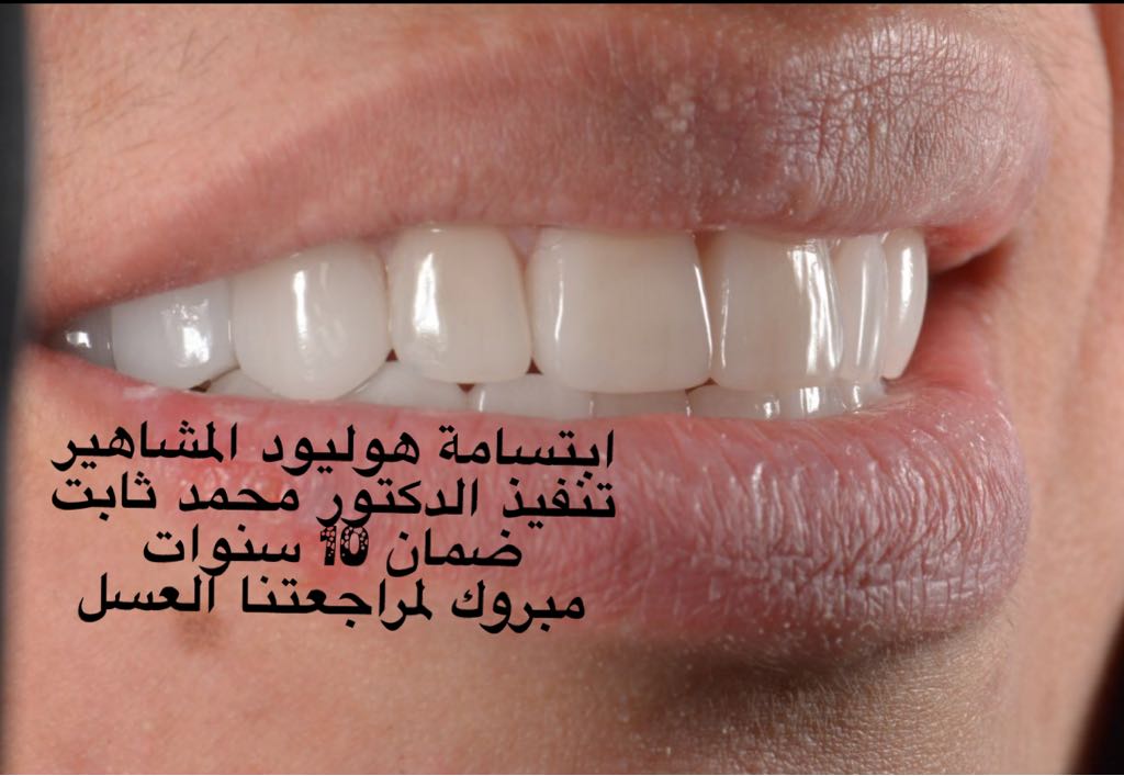عيادة اروكا لطب الاسنان والجلدية شمال الرياض 0545359682 