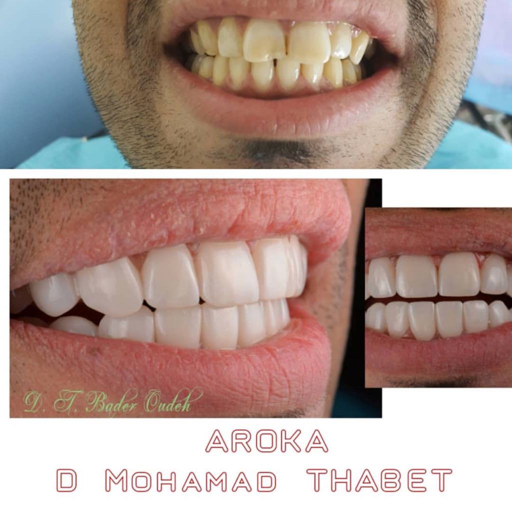 عيادة اروكا لطب الاسنان والجلدية شمال الرياض 0545359682 